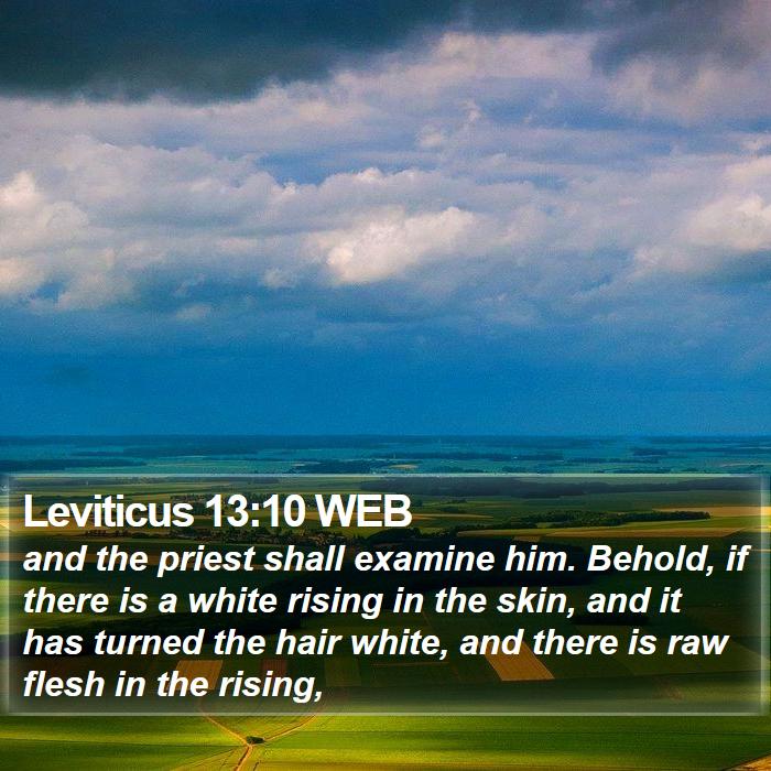 Leviticus 13:10 WEB Bible Study