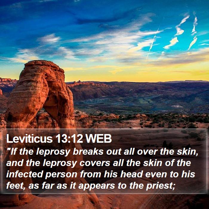 Leviticus 13:12 WEB Bible Study