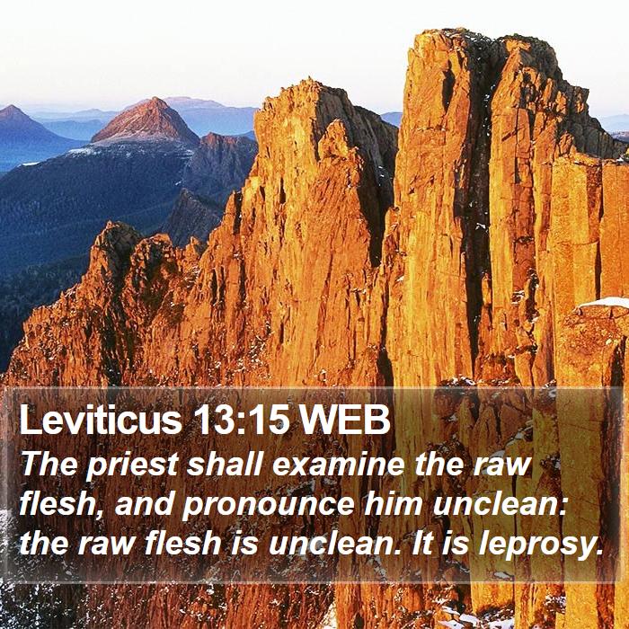 Leviticus 13:15 WEB Bible Study