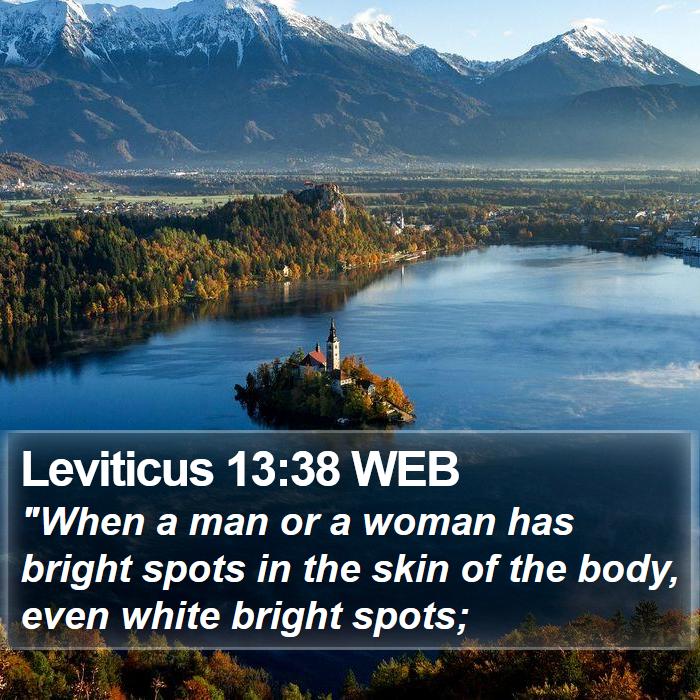 Leviticus 13:38 WEB Bible Study