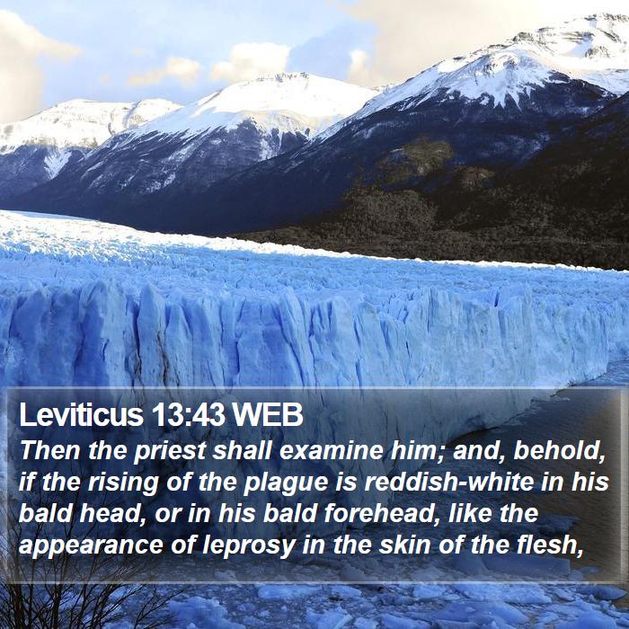 Leviticus 13:43 WEB Bible Study