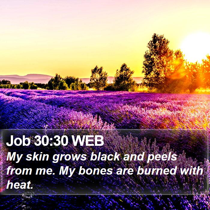 Job 30:30 WEB Bible Study